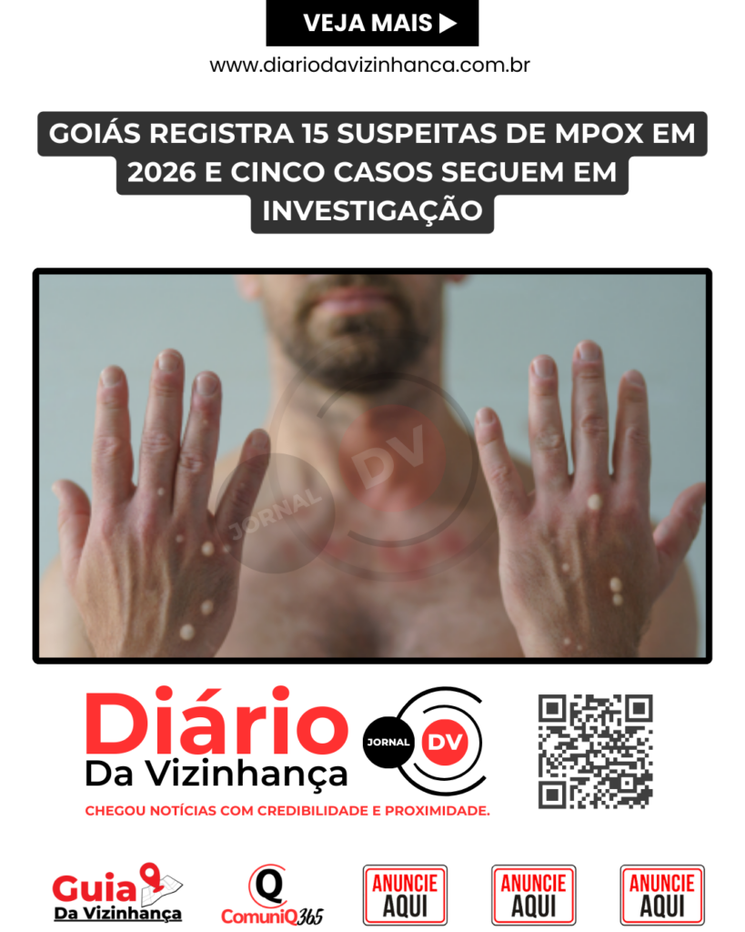 GOIÁS REGISTRA 15 SUSPEITAS DE MPOX EM 2026 E CINCO CASOS SEGUEM EM INVESTIGAÇÃO