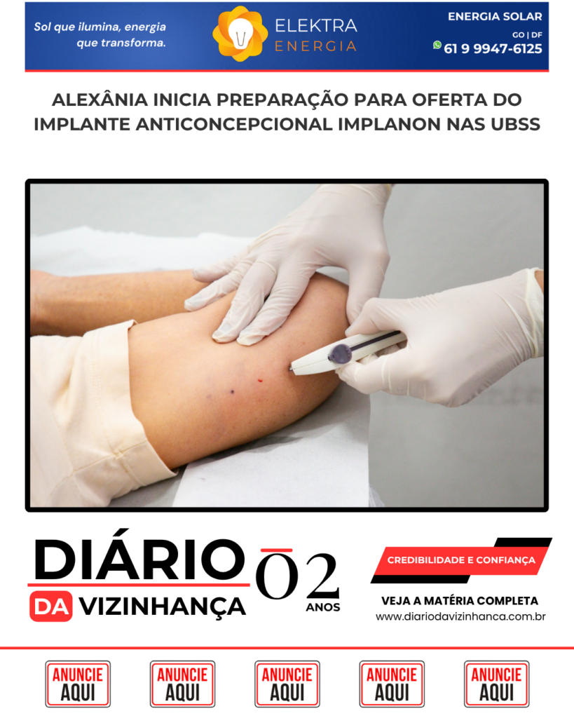 ALEXÂNIA INICIA PREPARAÇÃO PARA OFERTA DO IMPLANTE ANTICONCEPCIONAL IMPLANON NAS UBSs